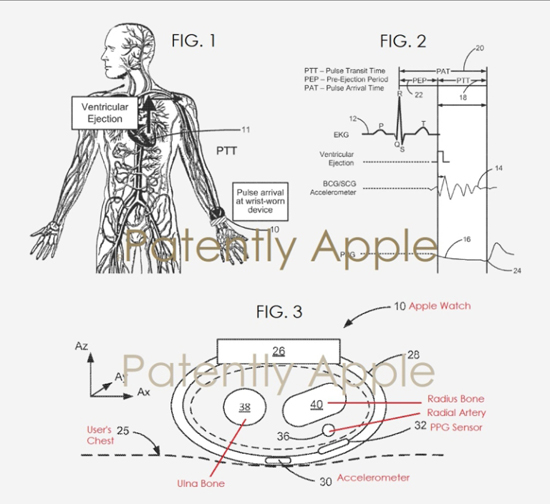 Основна ідея винаходу, описаного в патенті, полягає в тому, щоб оснастити ремінець   Apple   Watch акселерометром і додатковим сканером серцевого ритму, який необхідно прикладати до грудної клітки